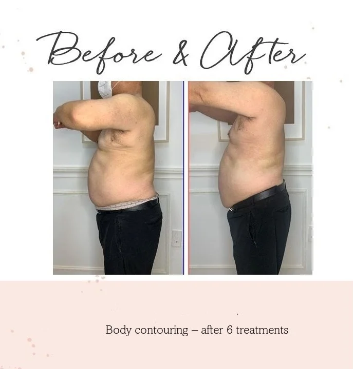 6-treatments-2