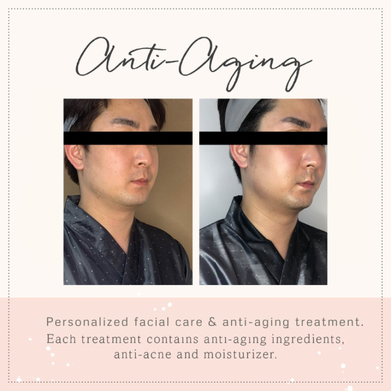 before and after _antiaging
