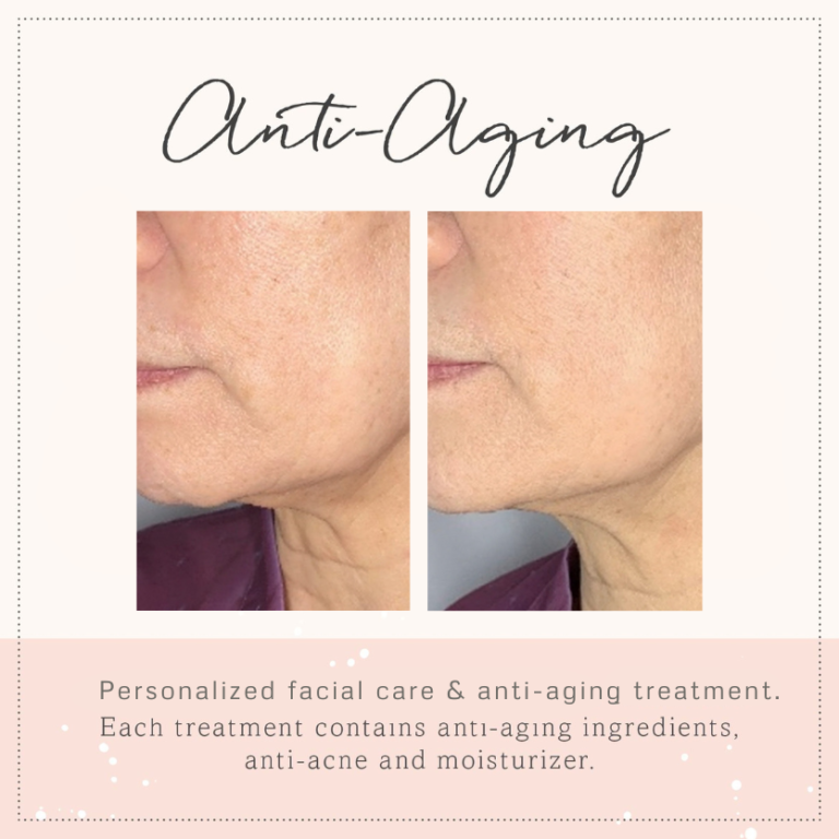 before and after _antiaging2