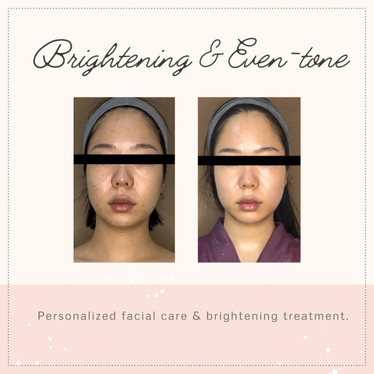 before and after_eventone